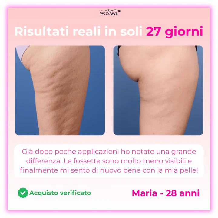 Wosawe™ - Massaggiatore drenante 2025