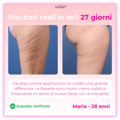 Wosawe™ - Massaggiatore drenante 2025