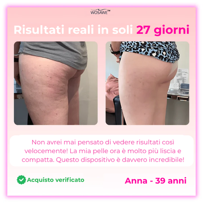 Wosawe™ - Massaggiatore drenante 2025