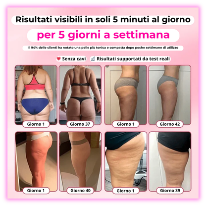 Wosawe™ - Massaggiatore drenante 2025